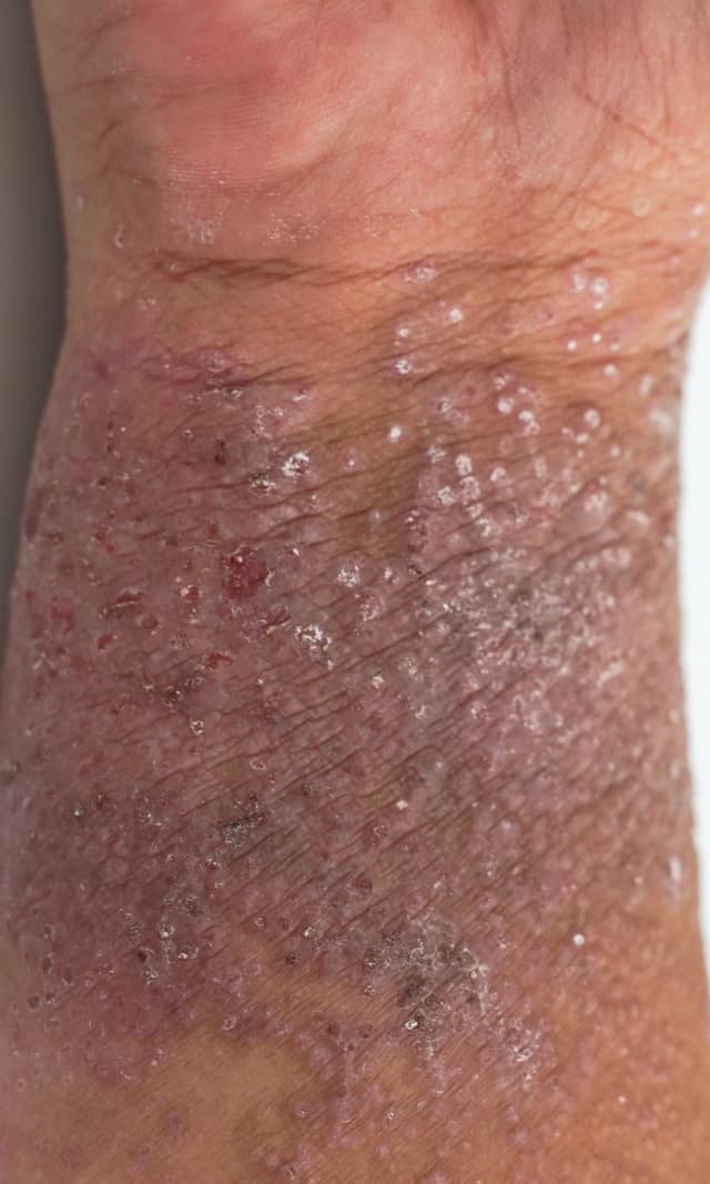 Skin Condition